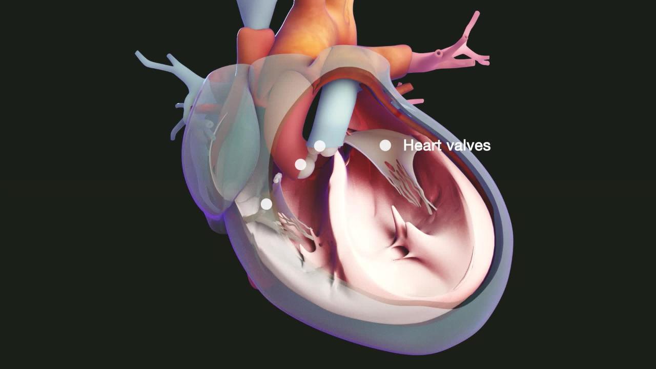 Сердечный стеноз. Трикуспидальный клапан стеноз. Миксома митрального клапана. Стеноз легочной артерии ЭХОКГ. Стеноз трехстворчатого клапана.