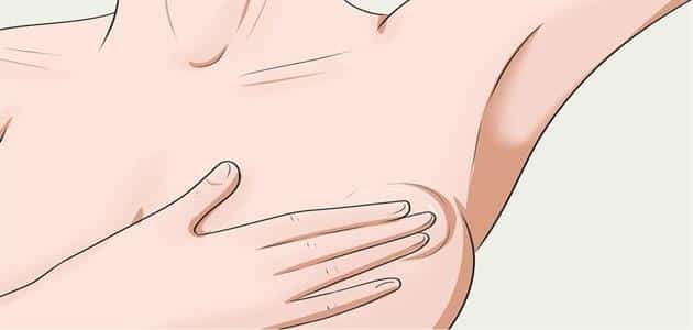 ما هي أعراض مرض سرطان الثدي بالتفصيل 1